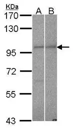 Anti-RanBP9 antibody used in Western Blot (WB). GTX106378