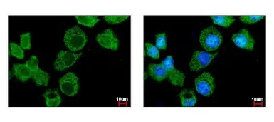 Anti-Importin 7 antibody [C3], C-term used in Immunocytochemistry/ Immunofluorescence (ICC/IF). GTX106408
