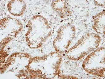 Anti-RGS14 antibody [C3], C-term used in IHC (Paraffin sections) (IHC-P). GTX106412