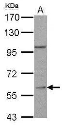 Anti-RGS14 antibody [C3], C-term used in Western Blot (WB). GTX106412