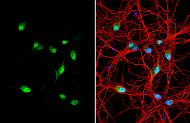 Anti-Centaurin alpha 1 antibody [C3], C-term used in Immunocytochemistry/ Immunofluorescence (ICC/IF). GTX106419