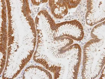 Anti-Centaurin alpha 1 antibody [C3], C-term used in IHC (Paraffin sections) (IHC-P). GTX106419