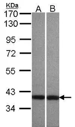 Anti-Centaurin alpha 1 antibody [C3], C-term used in Western Blot (WB). GTX106419