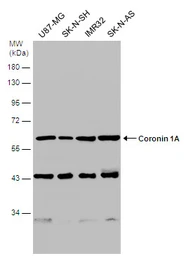 Anti-Coronin 1A antibody [C3], C-term used in Western Blot (WB). GTX106424