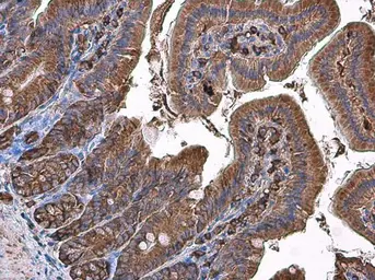Anti-Coronin 1A antibody [C3], C-term used in IHC (Paraffin sections) (IHC-P). GTX106424