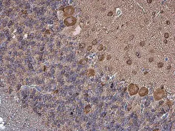 Anti-Coronin 1A antibody [C3], C-term used in IHC (Paraffin sections) (IHC-P). GTX106424