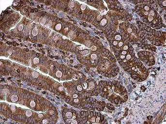 Anti-Coronin 1A antibody [C3], C-term used in IHC (Paraffin sections) (IHC-P). GTX106424