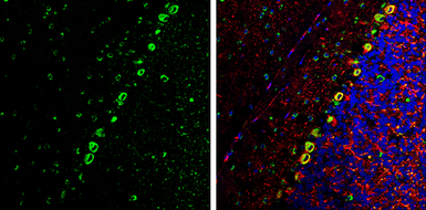 Anti-Coronin 1A antibody [C3], C-term used in IHC (Frozen sections) (IHC-Fr). GTX106424