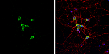 Anti-Coronin 1A antibody [C3], C-term used in Immunocytochemistry/ Immunofluorescence (ICC/IF). GTX106424