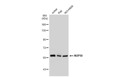 Anti-NUP50 antibody [C3], C-term used in Western Blot (WB). GTX106428