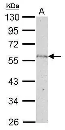 Anti-NUP50 antibody [C3], C-term used in Western Blot (WB). GTX106428