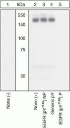 Anti-EGFR (phospho Tyr1148) antibody used in Western Blot (WB). GTX10643