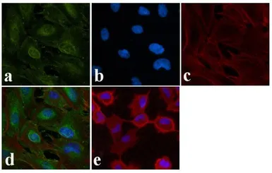 Anti-EGFR (phospho Tyr1148) antibody used in Immunocytochemistry/ Immunofluorescence (ICC/IF). GTX10643