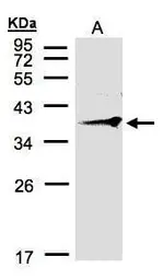 Anti-RNF2 antibody [C2C3], C-term used in Western Blot (WB). GTX106431