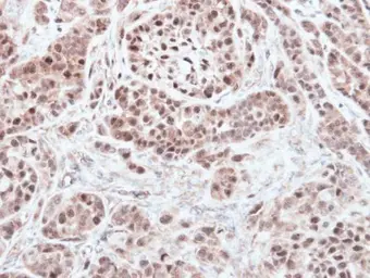 Anti-RNF13 antibody [C3], C-term used in IHC (Paraffin sections) (IHC-P). GTX106435