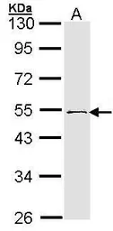 Anti-RNF13 antibody [C3], C-term used in Western Blot (WB). GTX106435