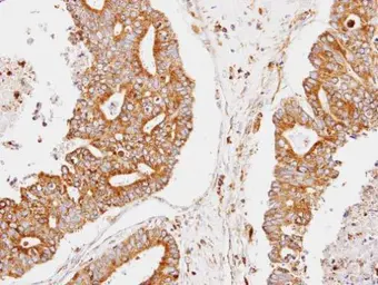 Anti-CCNDBP1 antibody [C2C3], C-term used in IHC (Paraffin sections) (IHC-P). GTX106440