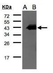 Anti-CCNDBP1 antibody [C2C3], C-term used in Western Blot (WB). GTX106440