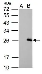 Anti-RGS17 antibody [C2C3], C-term used in Western Blot (WB). GTX106449