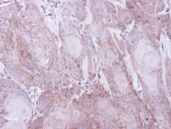 Anti-SEC61A1 antibody used in IHC (Paraffin sections) (IHC-P). GTX106455