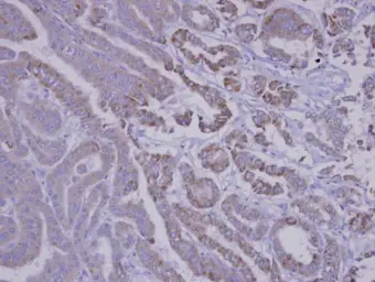 Anti-SNX12 antibody used in IHC (Paraffin sections) (IHC-P). GTX106456