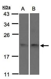 Anti-SNX12 antibody used in Western Blot (WB). GTX106456