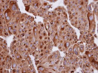 Anti-SERTAD1 antibody [N1N2], N-term used in IHC (Paraffin sections) (IHC-P). GTX106457
