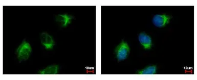 Anti-GGA3 antibody [C3], C-term used in Immunocytochemistry/ Immunofluorescence (ICC/IF). GTX106461