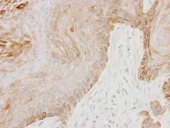 Anti-GGA3 antibody [C3], C-term used in IHC (Paraffin sections) (IHC-P). GTX106461