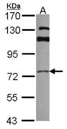 Anti-GGA3 antibody [C3], C-term used in Western Blot (WB). GTX106461