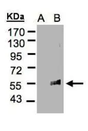 Anti-FLVCR antibody [C3], C-term used in Western Blot (WB). GTX106462