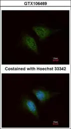 Anti-Coronin 1C antibody [C3], C-term used in Immunocytochemistry/ Immunofluorescence (ICC/IF). GTX106469