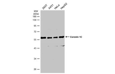 Anti-Coronin 1C antibody [C3], C-term used in Western Blot (WB). GTX106469