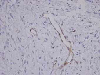 Anti-Coronin 1C antibody [C3], C-term used in IHC (Paraffin sections) (IHC-P). GTX106469