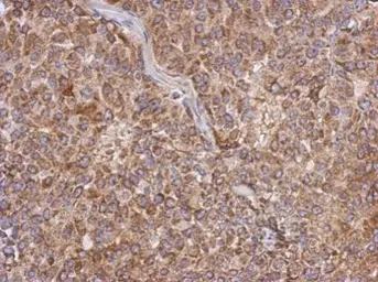 Anti-Apolipoprotein L1 antibody used in IHC (Paraffin sections) (IHC-P). GTX106472
