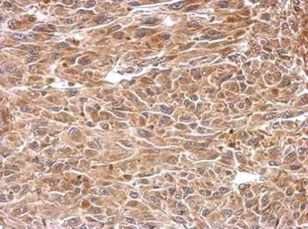 Anti-CESK1 antibody used in IHC (Paraffin sections) (IHC-P). GTX106479