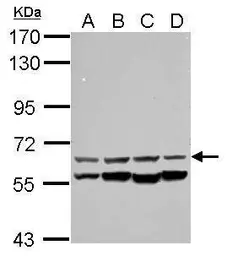 Anti-CESK1 antibody used in Western Blot (WB). GTX106479