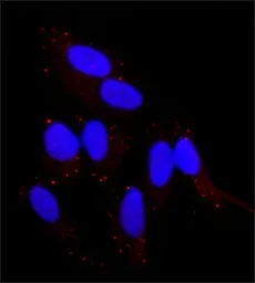 Anti-FGFR2 antibody used in Immunocytochemistry/ Immunofluorescence (ICC/IF). GTX10648