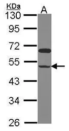 Anti-GRINL1A antibody used in Western Blot (WB). GTX106522