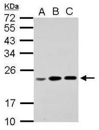 Anti-RPL17P7 antibody used in Western Blot (WB). GTX106546