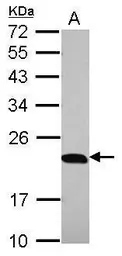 Anti-p23 antibody [N1C3] used in Western Blot (WB). GTX106550