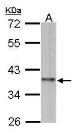 Anti-Cyclin I2 antibody [N3C3] used in Western Blot (WB). GTX106554