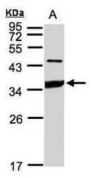 Anti-ICAM2 antibody [N1C2] used in Western Blot (WB). GTX106555