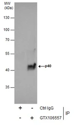 Anti-p40 antibody [N3C3] used in Immunoprecipitation (IP). GTX106557