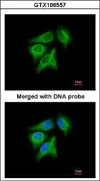 Anti-p40 antibody [N3C3] used in Immunocytochemistry/ Immunofluorescence (ICC/IF). GTX106557