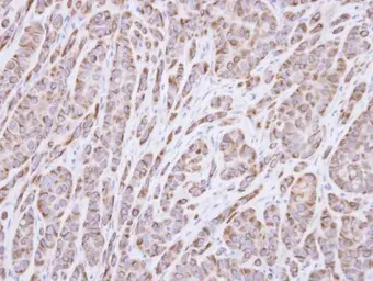 Anti-p40 antibody [N3C3] used in IHC (Paraffin sections) (IHC-P). GTX106557