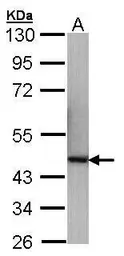 Anti-p40 antibody [N3C3] used in Western Blot (WB). GTX106557