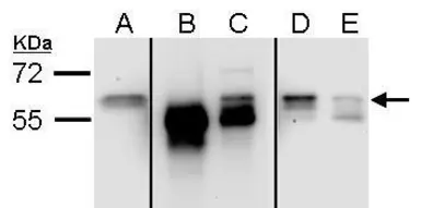 Anti-Staufen antibody used in Immunoprecipitation (IP). GTX106566