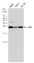 Anti-HN1 antibody used in Western Blot (WB). GTX106585