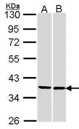 Anti-FAM50A antibody [N3C3] used in Western Blot (WB). GTX106590